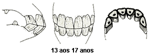 dente13