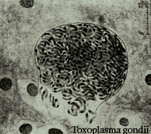 toxoplasma